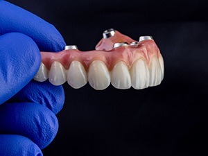 A gloved hand holding an implant denture